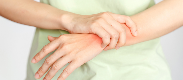 Theo dõi Bệnh mạn tính liên tục & chủ động