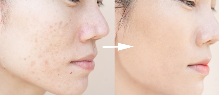 Ghi nhận hình ảnh trước – sau điều trị