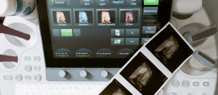 Timeline thai kỳ trực quan